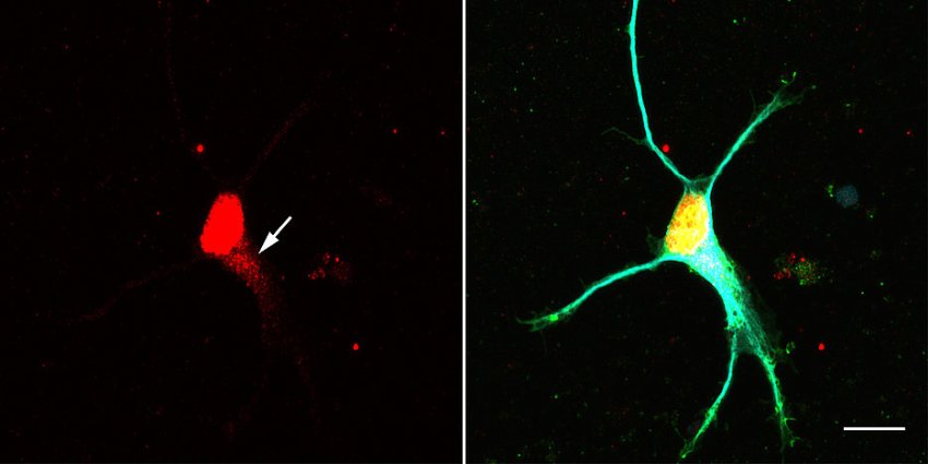 Larp7 accumulates in neuron arrow