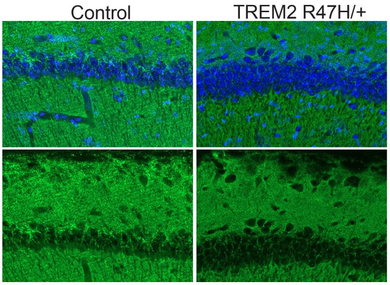 Level of protein in synapses with human left and mutant right microglia