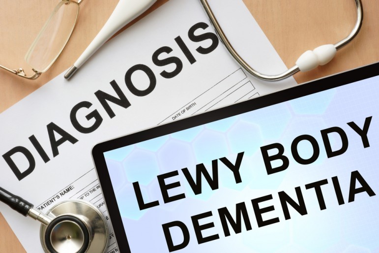 Demenza a Corpi di Lewy: una malattia sottovalutata