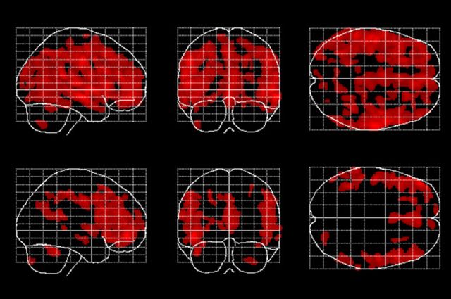 Sempre giovani: la meditazione può rallentare la perdita di materia grigia nel cervello