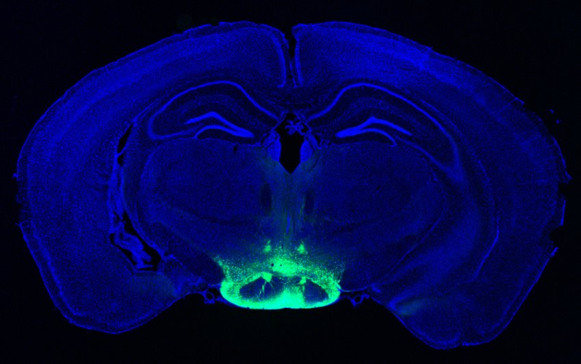 MIT cells especially vulnerable to Alzheimer