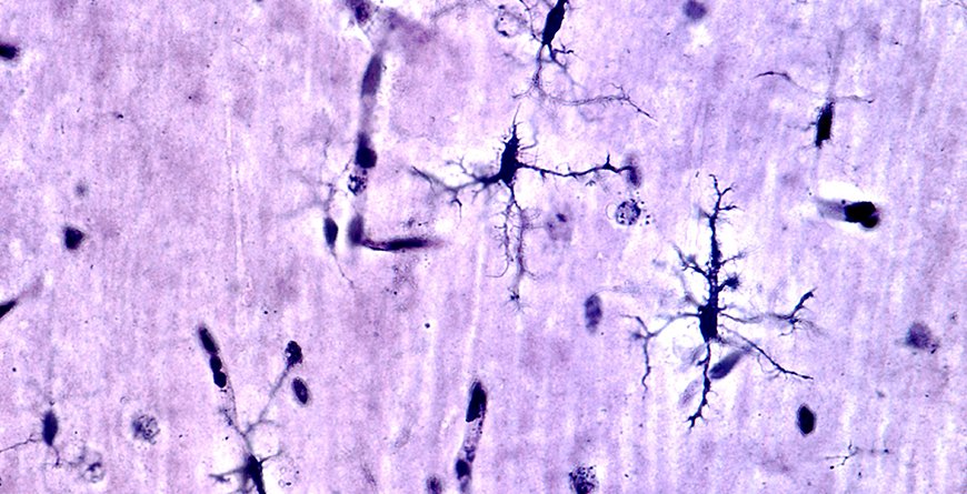 Microglia cells ASU Banner