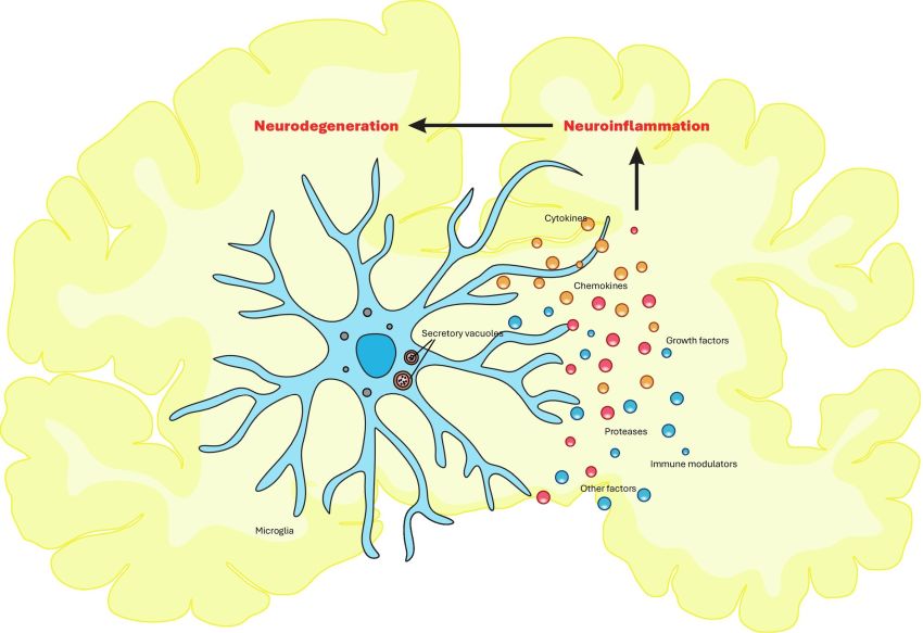 Microglia mediated neuroinflammation