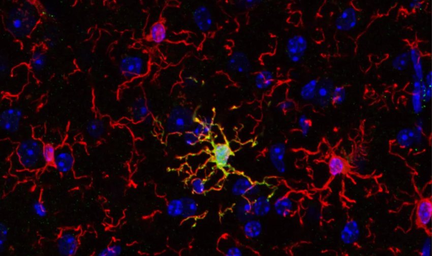 Microglia red surround an ARG1 microglia yellow that expresses ARG1 Vassilis Stratoulias