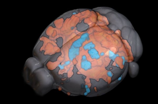 Mouse brain activity under optogenetic stimulation