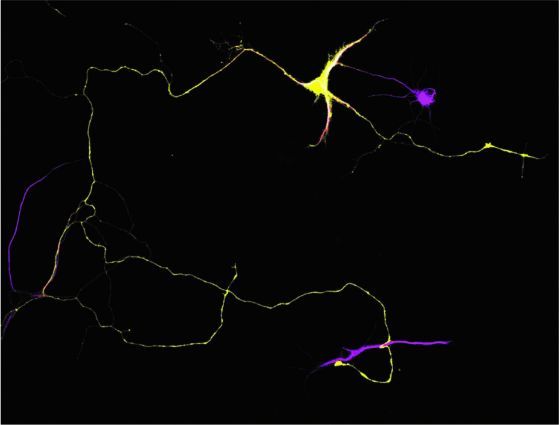 Mouse hippocampal neuron