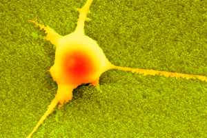 Nano-increspature nella materia cerebrale facilitano la vita dei neuroni