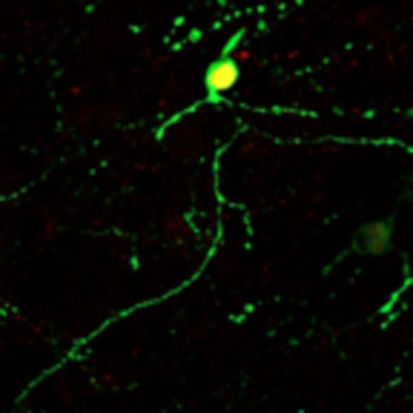 NeuroD1 Converted Neurons