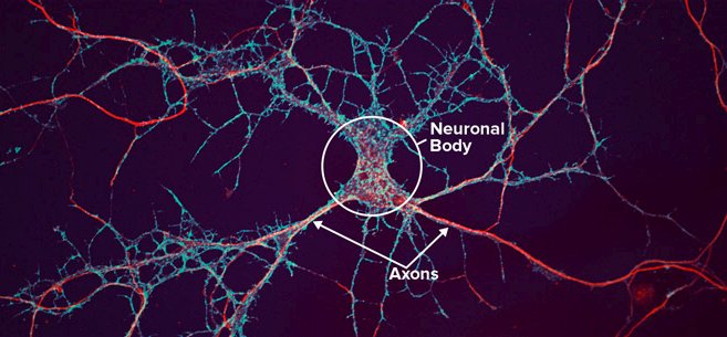 Neuron Body and Axons