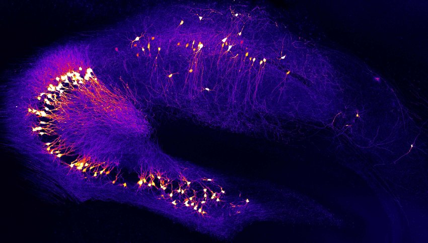 Neurons in the hippocampus