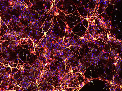 Cellule staminali della pelle trasformate in neuroni e cellule del cuore