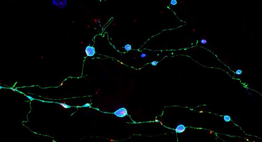 Neurons grown in culture expressing a mutant prion protein