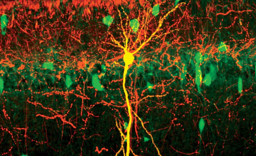 Neurons in hippocampus byTristan Geiller Losonczy Lab