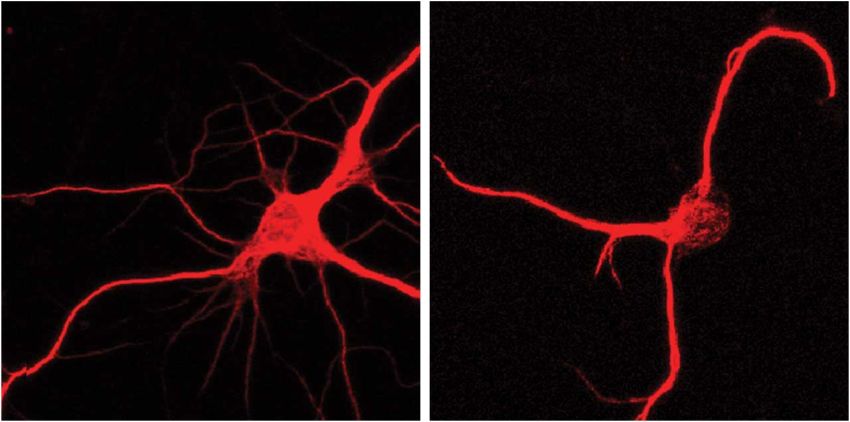Neurons in petri dishes without left and with right lot of FTL1