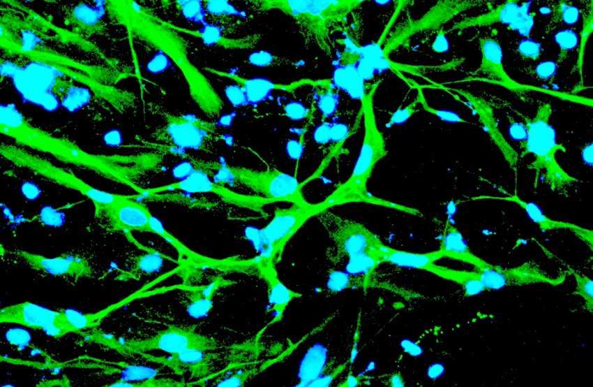 Neurons made from human induced pluripotent stem cells ASU