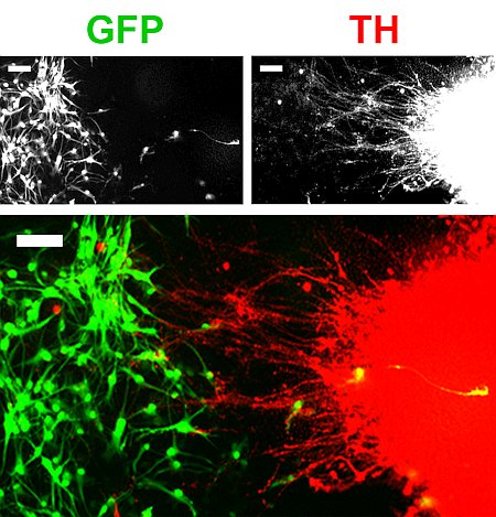 Prodotte cellule neuronali in-vitro complete delle connessioni tra loro