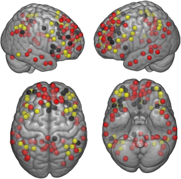 Nodes of default mode red frontoparietal yellow and salience black networks