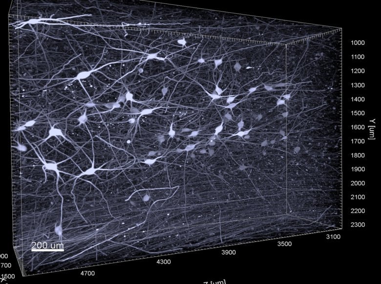 Noradrenergic neurons of the human locus coeruleus shell in 3D