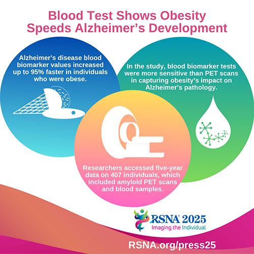 Obesity speeds up Alzheimer