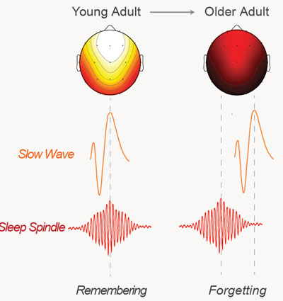 Ritmi cerebrali insoliti nel sonno fanno dimenticare gli anziani