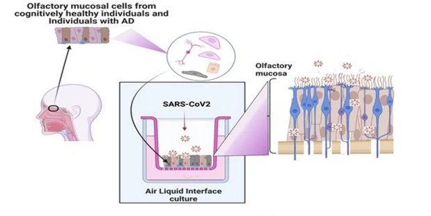 Olfactory mucosal cells alzheimer and covid19 