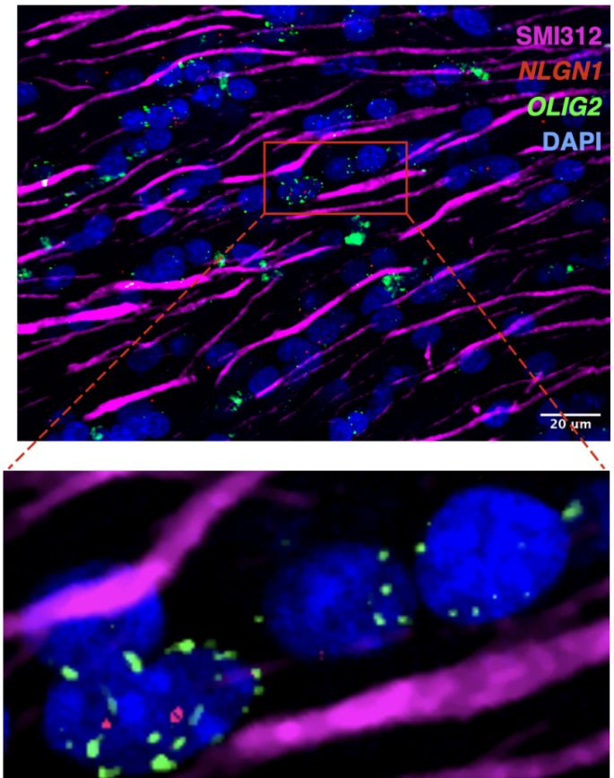 Oligodendrocyte NLGN1