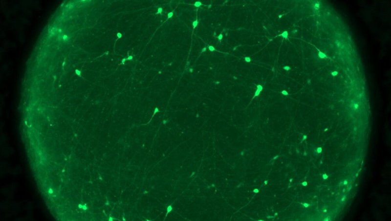 Organoid with neurons labeled in green