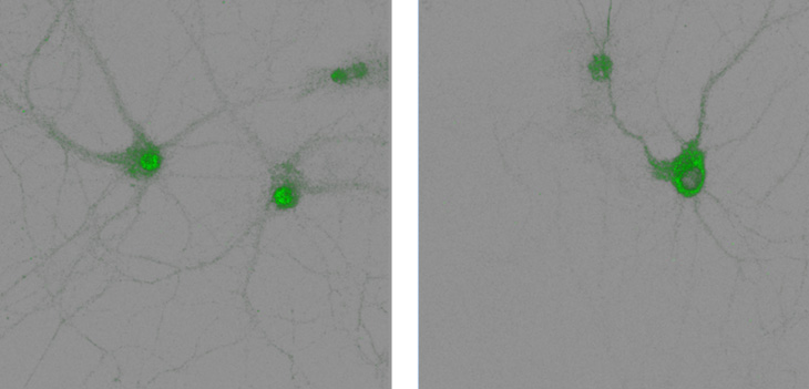 PDE4D5 in the nucleus of hippocampal neurons before left and after right activation of the adrenaline receptor
