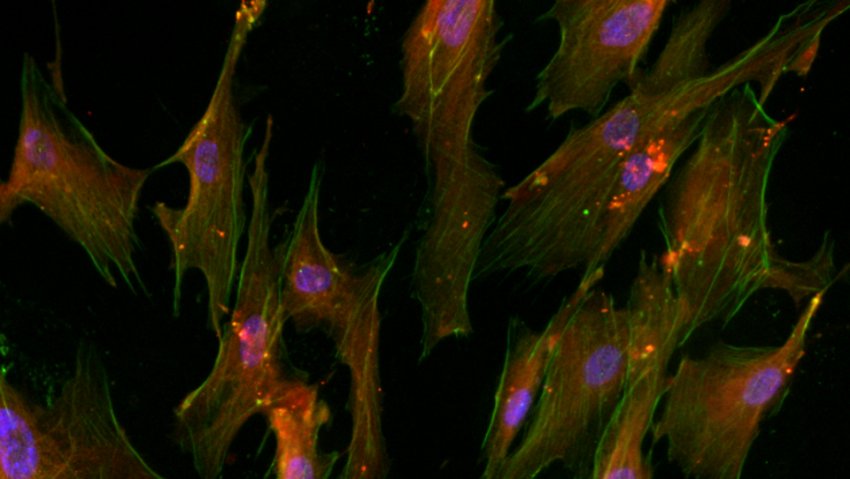 PSEN1 cholinergic