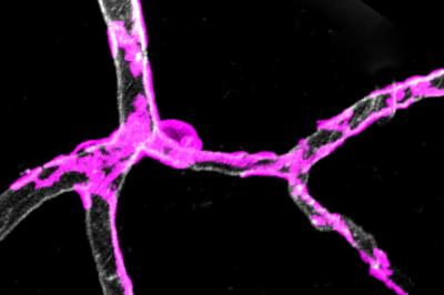 L'anomalia delle 'cellule-guardiane' soffoca lentamente i neuroni