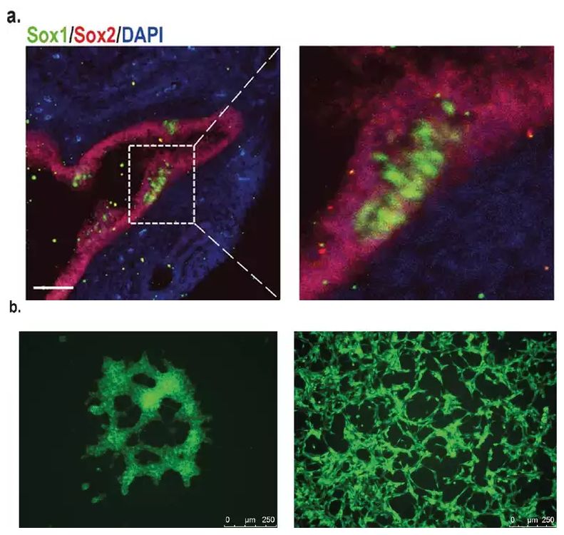 Peripheral neural stem cells in the mouse lung 