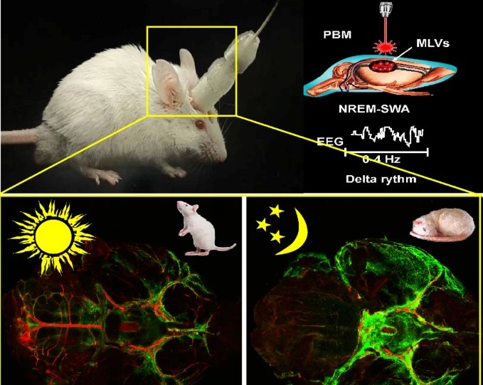 Phototherapy of Alzheimer during sleep