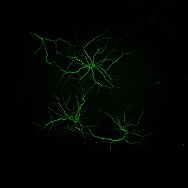 Primary neurons in culture labeled with an antibody
