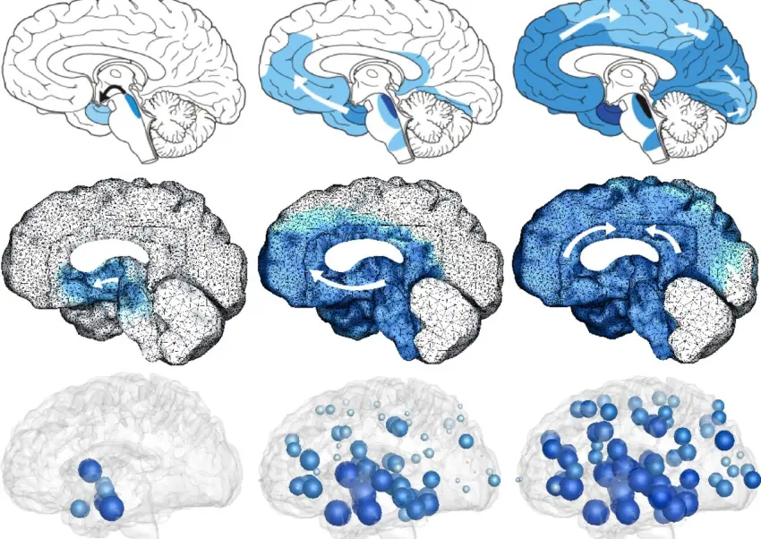 Prion-like spreading of alzheimers disease