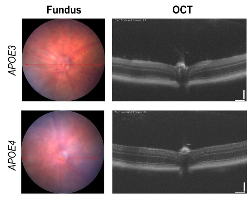 Reduced retinal thickness in APOE4 mice 