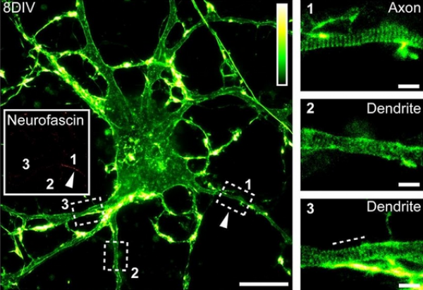 Danza dei neuroni: le vibrazioni dei cellule cerebrali possono aiutare a curare l'Alzheimer