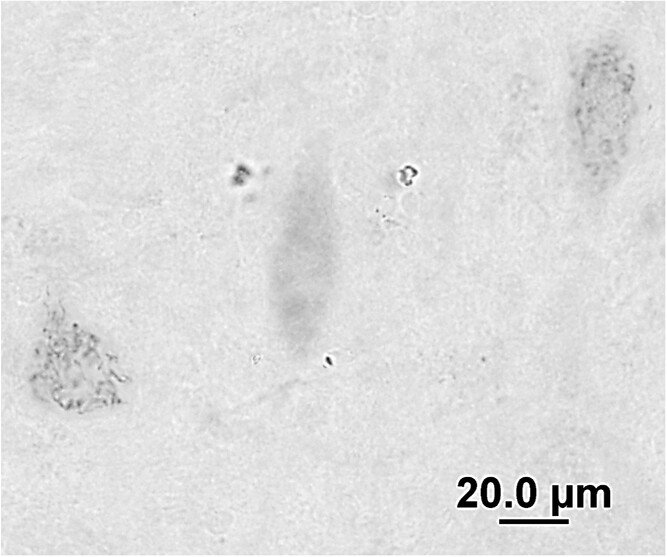 Stress granules detected by G3BP1 immunoreactivity within neurons