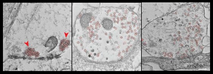 Synapses exposed to tau oligomers ParejaNavarro et al MolDegen