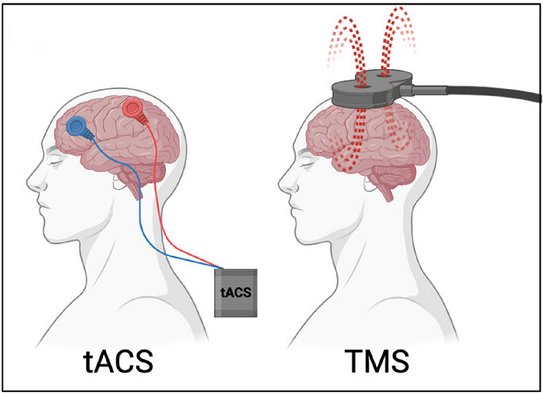 TAC vs TMS stimulation