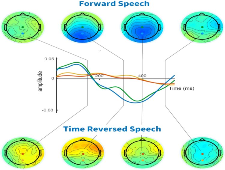 Scoperto il segnale cerebrale che indica se il linguaggio è stato compreso