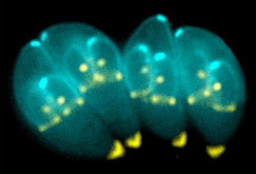 Il microscopico 'toxoplasma gondii' ha un ruolo nell'Alzheimer?