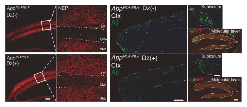 Treatment with diazoxide reduced Aβ pathology in mice with AD