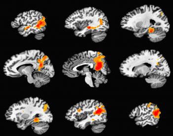 Trovato il meccanismo cerebrale che rafforza i ricordi rendendoli duraturi