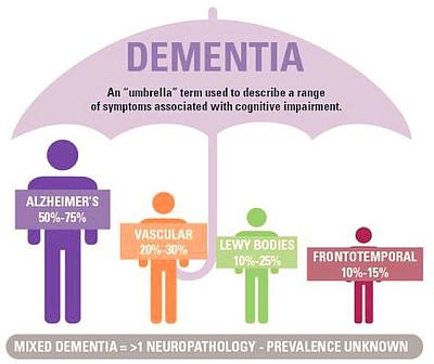 Oltre l'Alzheimer: i diversi tipi di demenza