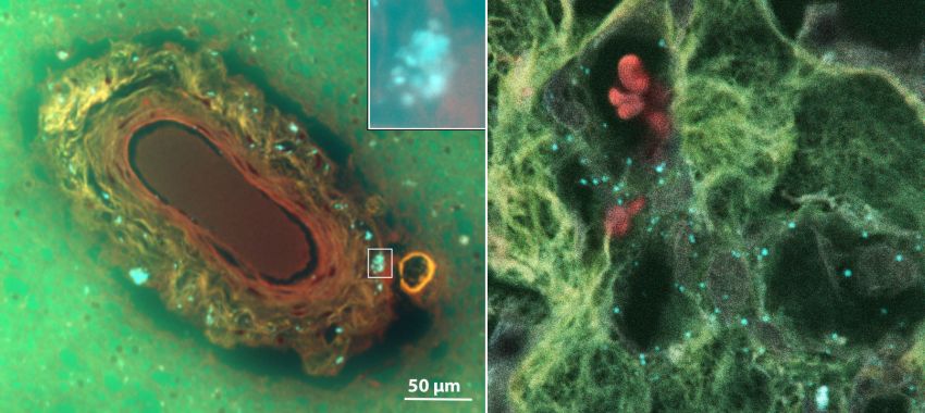 Vessel with plastics EBearer UniNewMexico