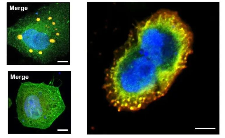 Defective cell and healthy cell