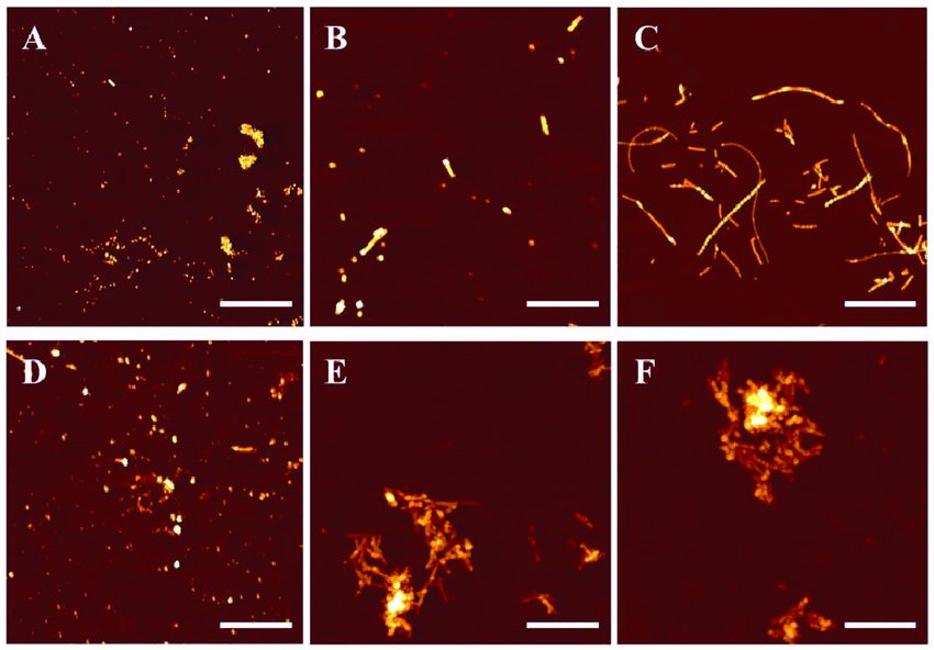 amyloid incubated without top and with copper below