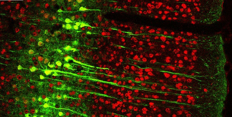 apical dendrites extending from neurons to somatosensory cortex.jpg
