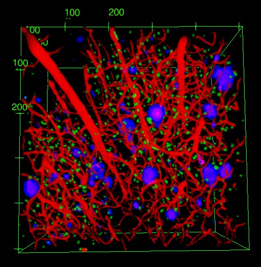 La geometria delle cellule del cervello potrebbe cambiare le strategie per l'Alzheimer