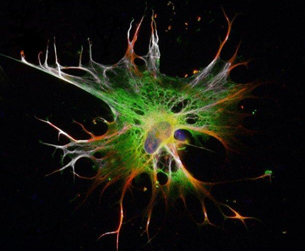 Ottenute cellule cerebrali da cellule staminali in modo rapido ed efficiente